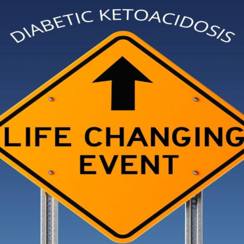 Life Changing Event - DKA
